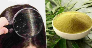 Neem Powder Benefits