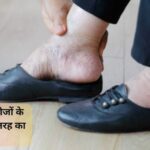 शुगर के मरीजों को खास तरह का जूता पहनना कितना जरूरी